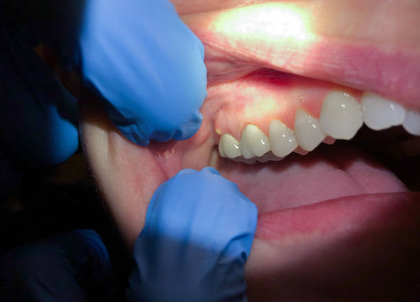 Best Emergency Orthodontic Repairs in New Market, TN