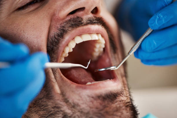 Best Urgent Dental Care for Toothaches in New Market, TN